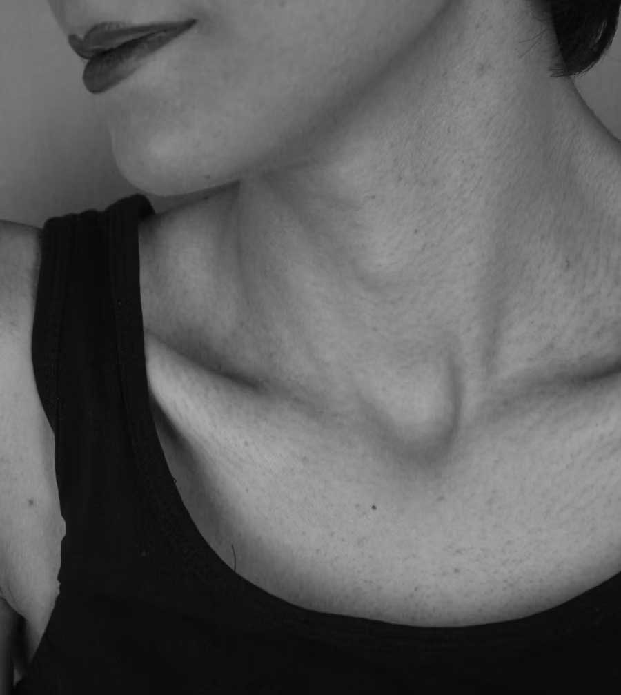 Thyroflex - Thyroid Function Testing